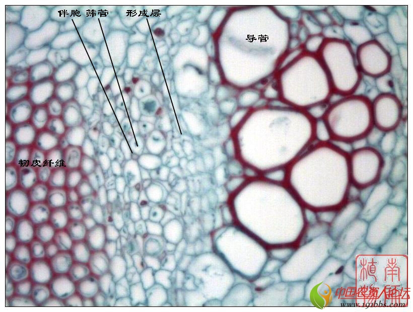 变褐的维管束----植物解剖学
