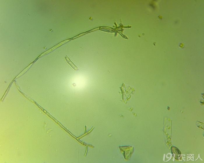 贡献一下我显微镜下的黄瓜霜霉病病原及其孢子看完加分啊