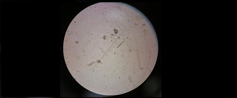 黄瓜黑星病病原孢子与实物超清晰图谱