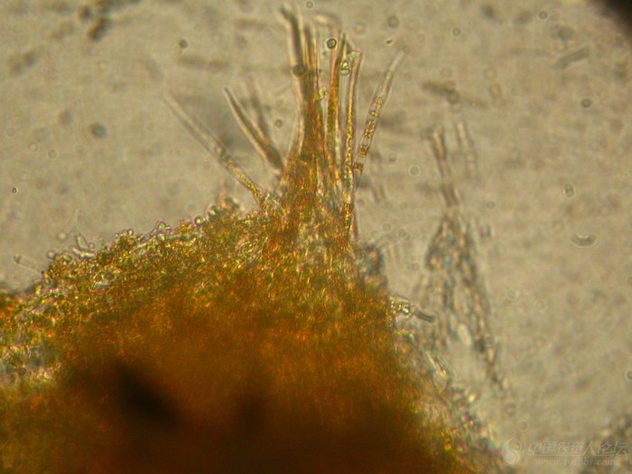 梨胶锈菌冬孢子图片