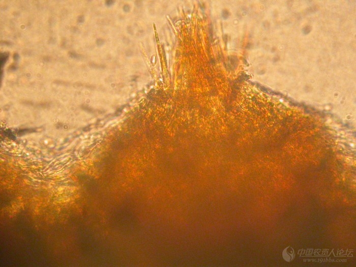 梨锈病冬孢子图片