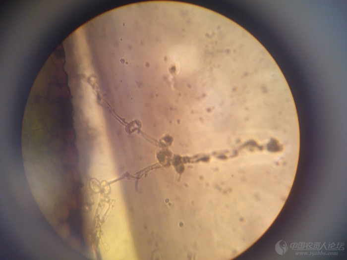 白锈菌显微镜图片