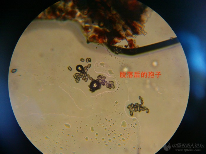 显微图像求鉴定