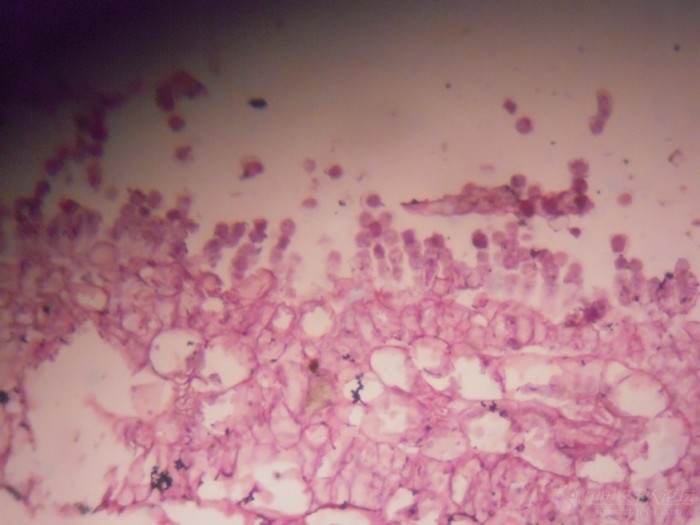 白锈菌显微镜图片